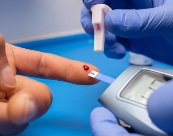 captura de um medico com luvas de borracha fazendo um exame de sangue de um paciente